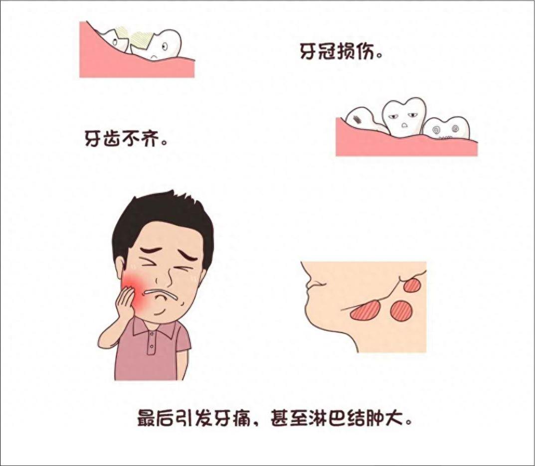口腔常识手册之智齿，一组图带你了解智齿为什么疼