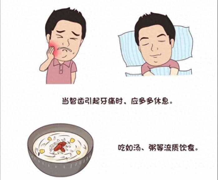 口腔常识手册之智齿，一组图带你了解智齿为什么疼