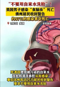 ​致死率97%！美国男子自来水洗脸致死，感染吸脑虫 到底有多可怕？
