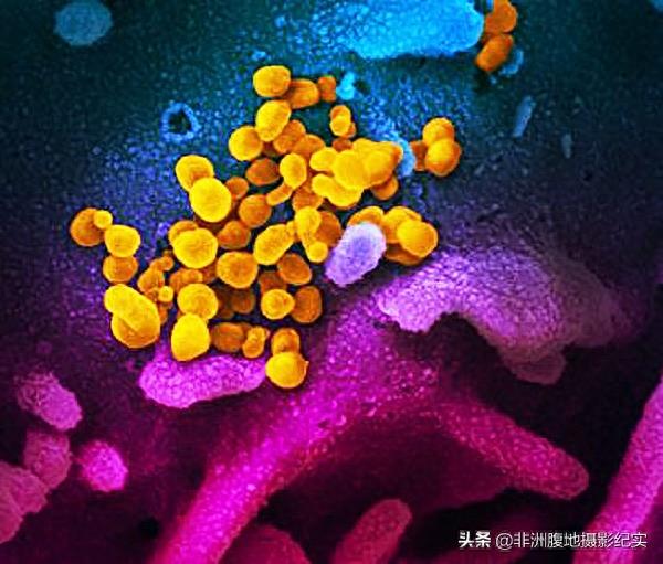 高清图片显示超级病毒真面目——真艳丽太恶毒