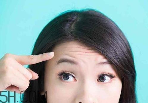 抬头纹可以用针灸治疗吗_怎么预防抬头纹 抬头纹可以用针灸治疗吗_怎么预防抬头纹
