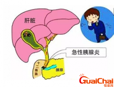 ​胰腺炎的症状有哪些明显表现 胰腺炎的症状有哪些变现和前兆