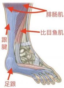 ​跟腱炎的治疗 总是足跟痛？你可能患上了跟腱炎