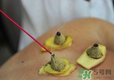 ​三伏灸可以自己灸吗？三伏灸可以在家做吗？