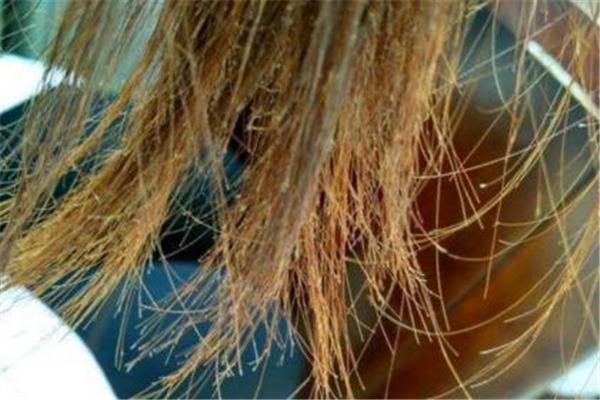 头发有分叉怎么办 头发有分叉怎么护理