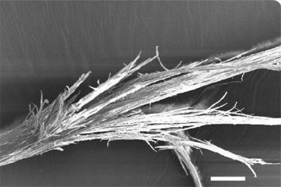 ​头发有分叉怎么办 头发有分叉怎么护理