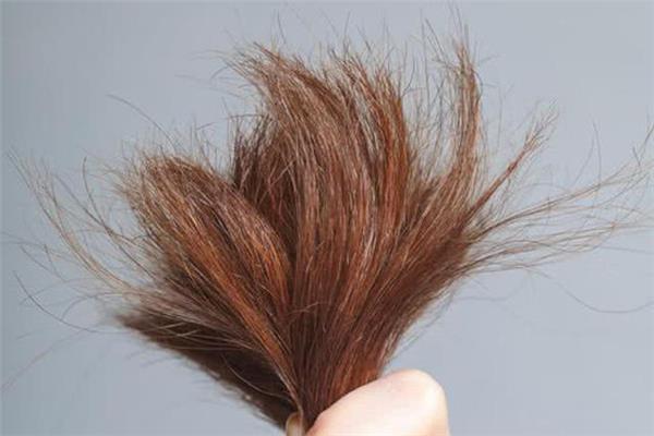 头发有分叉怎么办 头发有分叉怎么护理