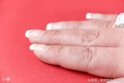 ​手指甲没有月牙是什么原因(女性手指甲没有月牙是什么原因)