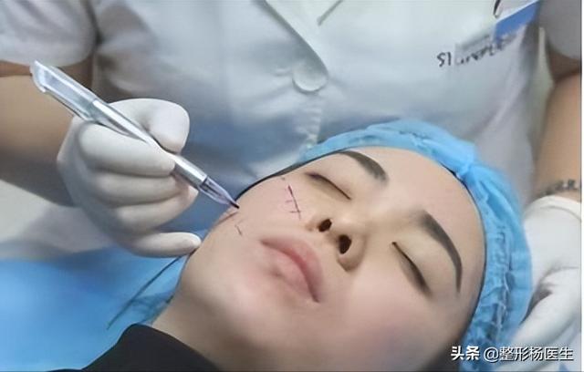 拉皮手术的费用多少（专业解答拉皮手术贵吗）(2)