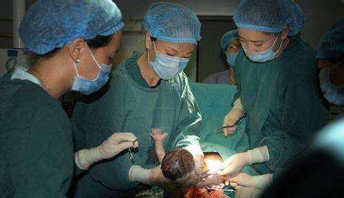 4年剖3胎，老婆真的不疼？剖过的女人：终于不用生了！