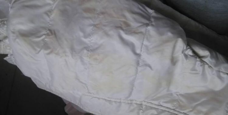 白色羽绒服洗完晾干后有黄渍如何处理掉